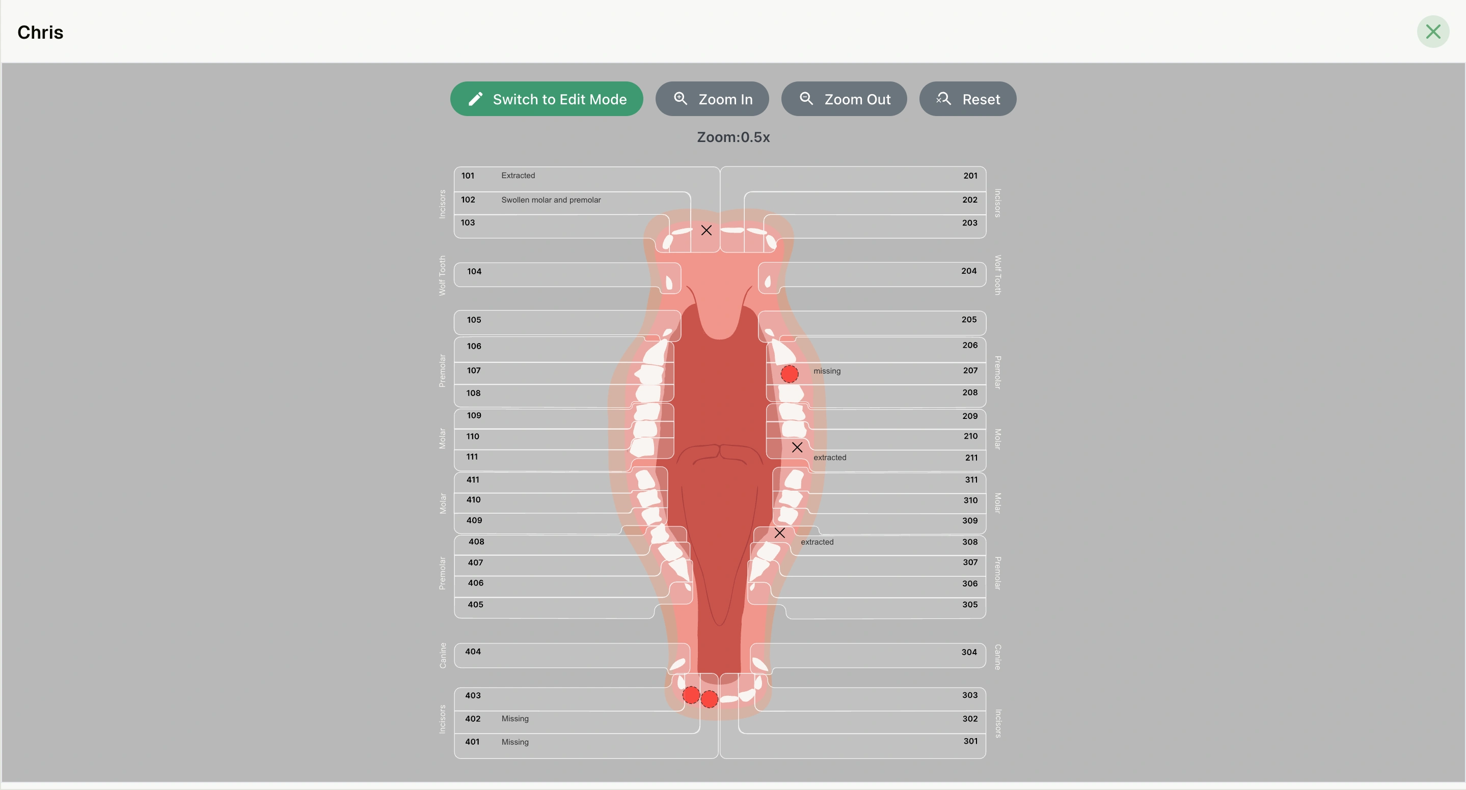 AI Enabled Medical Transcripts